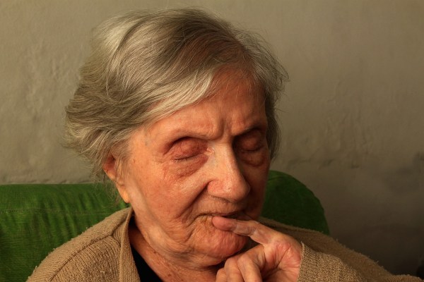 Die Rolle der Ernährung bei der Prävention von Alzheimer